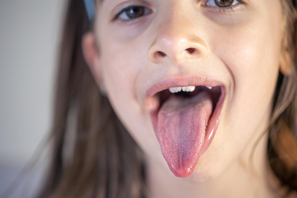 Biały nalot na języku u dziecka - przyczyny i leczenie